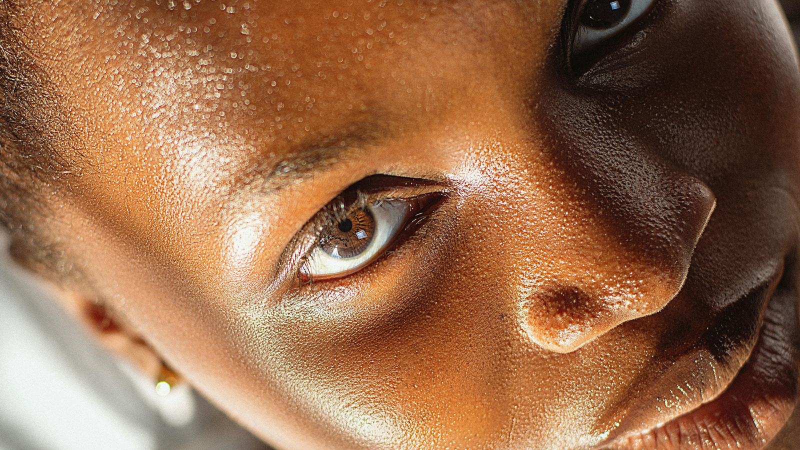 Why Gentle Preservatives Are Critical for Ocular Surface Integrity